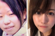 【画像】整形を繰り返しまくった女性が話題にｗｗｗｗｗｗｗｗｗｗ