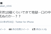 【悲報】鬼頭明里さん、口内炎が突然10個くらいできる...これは！？