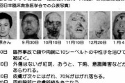 【画像】放射線被曝の末路がヤバすぎるｗｗｗｗｗｗｗｗｗｗｗｗｗｗ