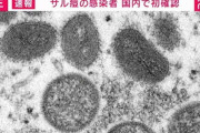 【悲報】サル痘、便座からも感染する…和式便所が天下とる時代に