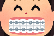 【朗報】31歳、歯列矯正を始める！！！
