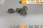 【悲報】日本さん、ガチのマジで終わる。国民が貧し過ぎてとうとう銀歯を売り始める??