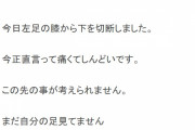 【悲報】コレステロールタクヤさん、糖尿悪化させ左足を切断していた…
